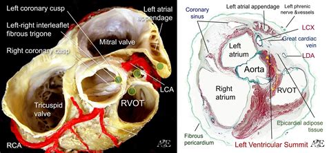 lv summit anatomy|anatomy of left ventricular summit.